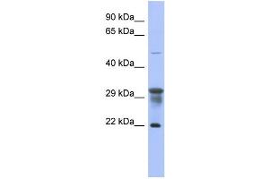 WB Suggested Anti-PMM1 Antibody Titration: 0. (PMM1 抗体  (N-Term))