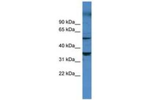 Image no. 1 for anti-Cytochrome P450, Family 11, Subfamily B, Polypeptide 1 (CYP11B1) (AA 202-251) antibody (ABIN6746766) (CYP11B1 抗体  (AA 202-251))