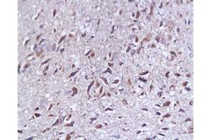 Formalin-fixed and paraffin embedded rat brain tissue labeled with Anti-SYP p38/Synaptophysin/SAP-1 Polyclonal Antibody, Unconjugated  at 1:200, followed by conjugation to the secondary antibody and DAB staining (SYAP1 抗体  (AA 151-230))
