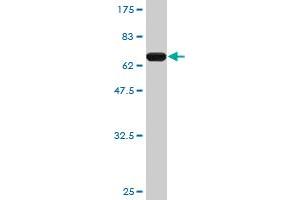 Western Blot detection against Immunogen (65. (PCBP2 抗体  (AA 1-362))