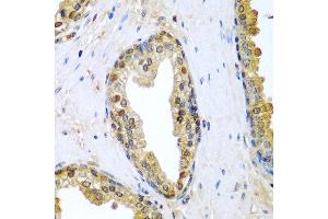 Immunohistochemistry of paraffin-embedded human prostate using TNFSF10 antibody at dilution of 1:200 (40x lens). (TRAIL 抗体)
