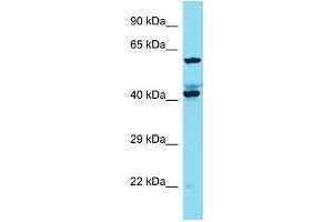 Western Blotting (WB) image for anti-KIAA1841 (KIAA1841) (C-Term) antibody (ABIN2791620) (KIAA1841 抗体  (C-Term))
