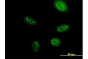 Immunofluorescence of purified MaxPab antibody to ZNF501 on HeLa cell. (ZNF501 抗体  (AA 1-262))