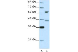 Western Blotting (WB) image for anti-Regulatory Factor X 4 (RFX4) antibody (ABIN2460674)