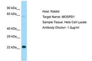 MOSPD1 antibody  (N-Term)