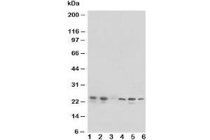 Western blot testing of HSPB1 antibody and Lane 1:  rat liver;  and human samples 2: HeLa;  3: MCF-7;  4: HT1080;  5: COLO320 cell lysate. (HSP27 抗体  (Middle Region))