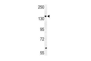ABCB4- (ABIN390060 and ABIN2840588) western blot analysis in mouse heart tissue lysates (35 μg/lane).