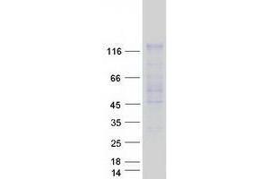 Western Blotting (WB) image for Ubiquitin Specific Peptidase 20 (USP20) (Transcript Variant 1) protein (Myc-DYKDDDDK Tag) (ABIN2735100)