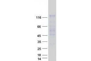 Validation with Western Blot (USP20 Protein (Transcript Variant 1) (Myc-DYKDDDDK Tag))