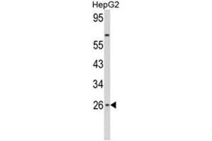 Western blot analysis of IFNB1 Antibody (N-term) in HepG2 cell line lysates (35ug/lane). (IFNB1 抗体  (N-Term))