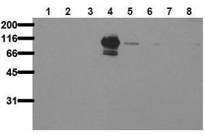 Western Blotting (WB) image for anti-PTK2B Protein tyrosine Kinase 2 beta (PTK2B) (pTyr402) antibody (ABIN126880) (PTK2B 抗体  (pTyr402))