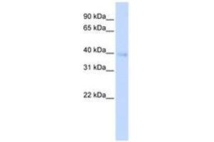 Image no. 1 for anti-Homeobox A11 (HOXA11) (AA 144-193) antibody (ABIN6741430) (Homeobox A11 抗体  (AA 144-193))