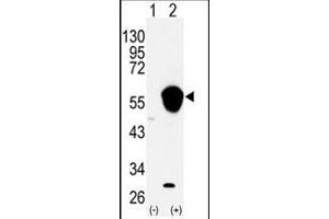 Image no. 1 for anti-Aldehyde Dehydrogenase 3 Family, Member A1 (ALDH3A1) (N-Term) antibody (ABIN360202) (ALDH3A1 抗体  (N-Term))