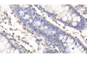 Immunohistochemistry (IHC) image for anti-Von Willebrand Factor A Domain Containing 2 (vWA2) (AA 457-708) antibody (ABIN7442516)