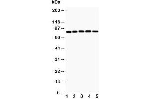 Western blot testing of IKK alpha antibody and Lane 1:  MCF-7;  2: SGC;  3: PANC;  4: HeLa;  5: mouse heart (IKK alpha 抗体  (AA 411-745))