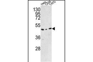 Western blot analysis of C9orf156 Antibody (C-term) (ABIN390925 and ABIN2841127) in Hela, CEM, T47D cell line lysates (35 μg/lane). (C9orf156 抗体  (C-Term))
