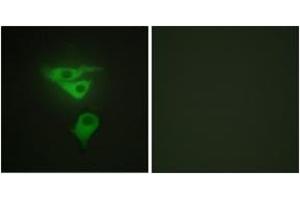 Immunofluorescence analysis of HepG2 cells, using PDLIM1 Antibody. (PDLIM1 抗体  (AA 61-110))
