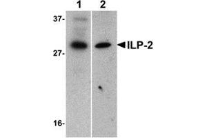 Western blot analysis of ILP-2 expression in human HepG2 (lane 1) and MOLT4 (lane 2) cell lysates with AP30430PU-N ILP-2 antibody at 1 μg/ml. (ILP-2 抗体)