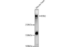 Western blot analysis of extracts of Mouse heart, using RYR2 antibody (ABIN1513493, ABIN3020906, ABIN3020907 and ABIN6213787) at 1:710 dilution. (RYR2 抗体  (AA 4850-4950))