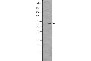 Western blot analysis of BIN2 expression in HepG2 whole cell lysate ,The lane on the left is treated with the antigen-specific peptide. (BIN2 抗体  (Internal Region))