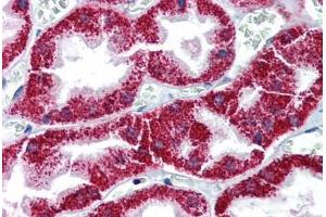 Human Kidney (formalin-fixed, paraffin-embedded) stained with BAX antibody ABIN337236 at 10 ug/ml followed by biotinylated anti-mouse IgG secondary antibody ABIN481714, alkaline phosphatase-streptavidin and chromogen. (BAX 抗体)