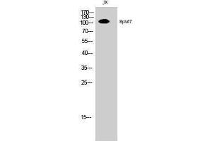 Western Blotting (WB) image for anti-EPH Receptor A7 (EPHA7) (Ser347) antibody (ABIN3178054) (EPH Receptor A7 抗体  (Ser347))