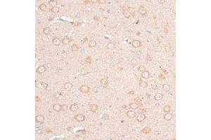 Immunohistochemistry of paraffin-embedded mouse brain using CDH18 antibody (ABIN6291131) at dilution of 1:100 (40x lens). (CDH18 抗体)