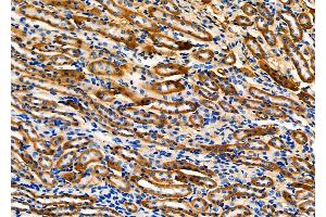 ABIN6257193 and ABIN6275124 at 1/100 staining Mouse kidney tissue by IHC-P.