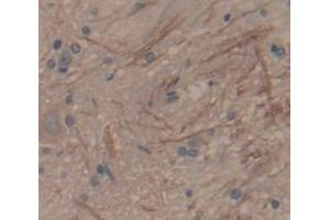IHC-P analysis of Rat Tissue, with DAB staining. (SFRP1 抗体  (AA 8-153))