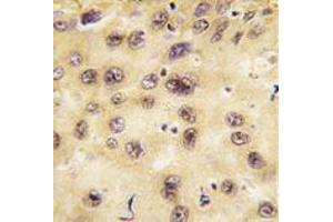 Image no. 3 for anti-Prospero Homeobox 1 (PROX1) (Center) antibody (ABIN357418) (PROX1 抗体  (Center))
