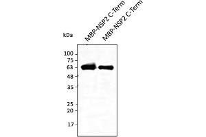 Western Blotting (WB) image for anti-SARS-CoV-2 Non-Structural Protein 2 (NSP2) (C-Term) antibody (ABIN7272997) (SARS-CoV-2 NSP2 抗体  (C-Term))