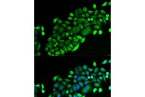 Immunofluorescence analysis of U2OS cells using GSTO2 Polyclonal Antibody (GSTO2 抗体)