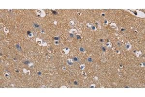 Immunohistochemistry of paraffin-embedded Human brain tissue using GSTA2 Polyclonal Antibody at dilution 1:50