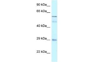 WB Suggested Anti-GFRA4 Antibody Titration: 1. (GFRA4 抗体  (C-Term))