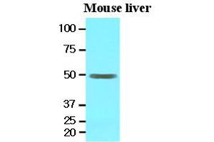 Western Blotting (WB) image for anti-Epoxide Hydrolase 1, Microsomal (Xenobiotic) (EPHX1) (AA 21-455) antibody (ABIN371868) (EPHX1 抗体  (AA 21-455))