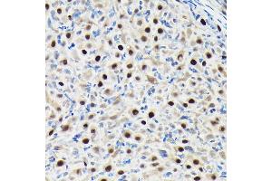 Immunohistochemistry of paraffin-embedded rat ovary using GTPBP4 Rabbit pAb (ABIN1680142, ABIN3019054, ABIN3019055 and ABIN6220689) at dilution of 1:50 (40x lens). (GTPBP4 抗体  (AA 385-634))