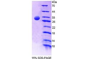 SDS-PAGE (SDS) image for Protein tyrosine Phosphatase, Non-Receptor Type 5 (Striatum-Enriched) (PTPN5) (AA 331-558) protein (His tag) (ABIN6239265) (PTPN5 Protein (AA 331-558) (His tag))