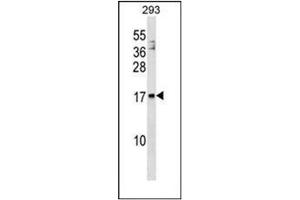 Western blot analysis of ARMET / ARP Antibody (N-term) in 293 cell line lysates (35ug/lane). (MANF 抗体  (N-Term))