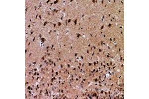 Immunohistochemical analysis of NFAT5 staining in human brain formalin fixed paraffin embedded tissue section. (NFAT5 抗体  (N-Term))