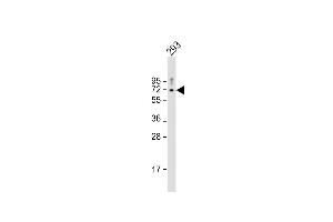 Western Blotting (WB) image for anti-Protein Kinase, AMP-Activated, alpha 2 Catalytic Subunit (PRKAA2) (AA 265-294) antibody (ABIN6243027)