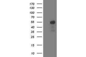 Western Blotting (WB) image for anti-Aminoacylase 1 (ACY1) antibody (ABIN1496453) (Aminoacylase 1 抗体)
