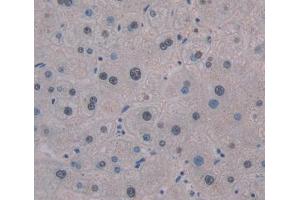 IHC-P analysis of liver tissue, with DAB staining. (SMUG1 抗体  (AA 1-270))