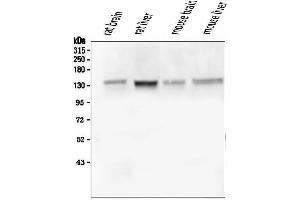 Western blot analysis of GM130 using anti-GM130 antibody (ABIN6719433). (Golgin A2 (GOLGA2) (AA 796-913) 抗体)