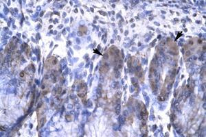 Image no. 1 for anti-Orthodenticle Homeobox 2 (OTX2) (AA 86-135) antibody (ABIN6735803) (OTX2 抗体  (AA 86-135))