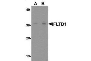 Western blot analysis of IFLTD1 in rat liver tissue lysate with IFLTD1 antibody at (A) 1 and (B) 2 ug/mL. (PAS1C1 抗体  (Middle Region))
