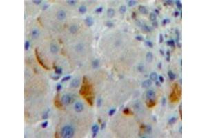 Immunohistochemistry (IHC) image for anti-Protocadherin 1 (PCDH1) (AA 575-812) antibody (ABIN1860137)