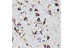 Immunohistochemistry of paraffin-embedded human brain using Cathepsin D antibody (ABIN7266149) at dilution of 1:100 (40x lens). (Cathepsin D 抗体)
