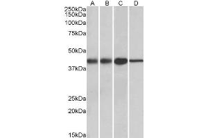 ABIN571082 (0. (ACAT1 抗体  (AA 257-269))