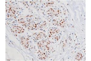 Immunohistochemistry (IHC) image for anti-Mast/stem Cell Growth Factor Receptor (KIT) (pTyr703) antibody (ABIN6255994)
