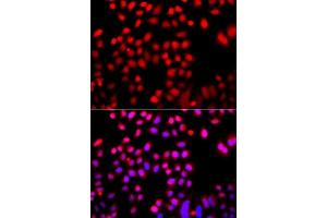 Immunofluorescence analysis of A549 cells using CFL2 antibody. (Cofilin 2 抗体  (AA 1-166))